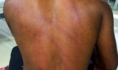 सोनई पोलिसांची बेकायदेशीर कारवाई, गणेश वाडी येथील युवकास विनाकारण बेदम मारहाण.