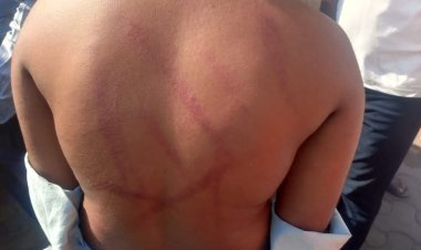 शिवशंभु विचारांचा प्रचार-प्रसार करणाऱ्या तरुणास पोलिसांकडून मारहाण, PSI वर कारवाईची मागणी.