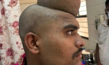 श्री साईबाबा हॉस्पिटलमधील डॉक्टरांच्या प्रयत्नांनी उतरला डोक्यावरील गाठीचा डोंगर!