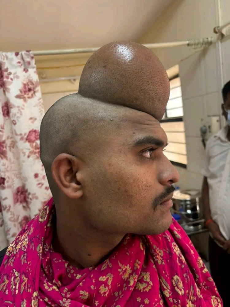 श्री साईबाबा हॉस्पिटलमधील डॉक्टरांच्या प्रयत्नांनी उतरला डोक्यावरील गाठीचा डोंगर!